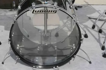 1977 Vistalite set question(s)